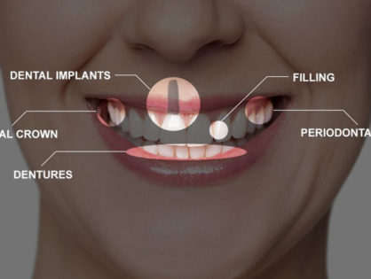 Full mouth rehabilitation and dental restoration at Gupta Dental Hospital Chandigarh